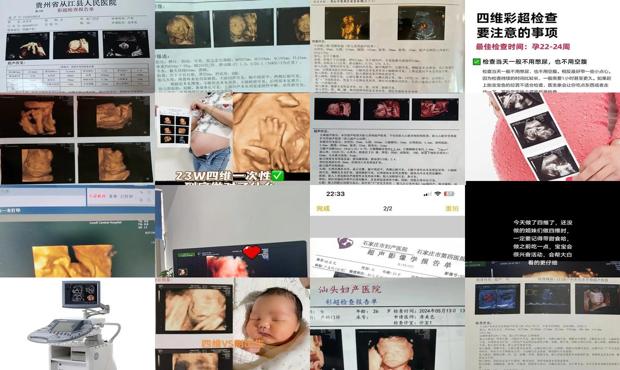 汕头四维彩超的好处