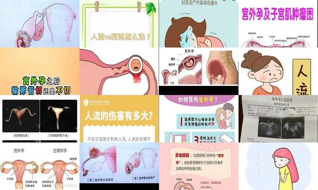 汕头宫外孕会意外流产吗