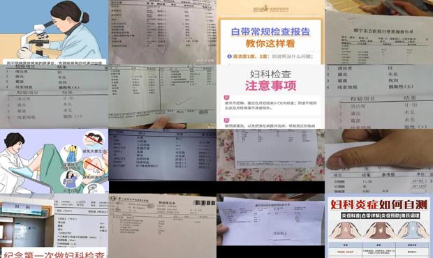 汕头什么时候可以做白带检查