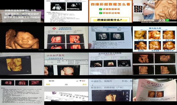 汕头四维彩超几个月*合适