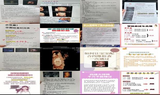 汕头四维*佳检查时间