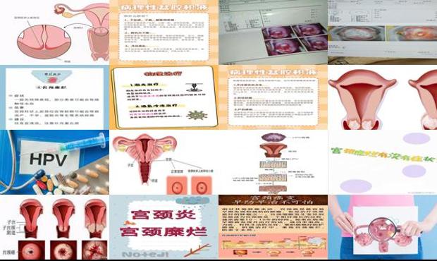 汕头宫颈糜烂会引起不孕吗