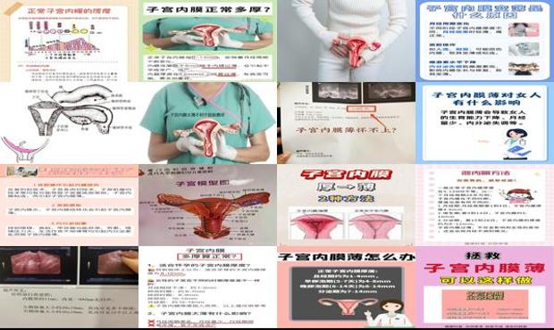 汕头子宫膜薄能检查么